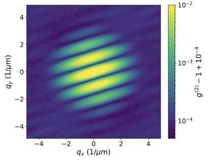 Zum Artikel "Innovative method exploits the quantum nature of X-ray light"